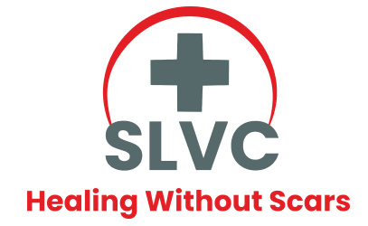 slvc.webp